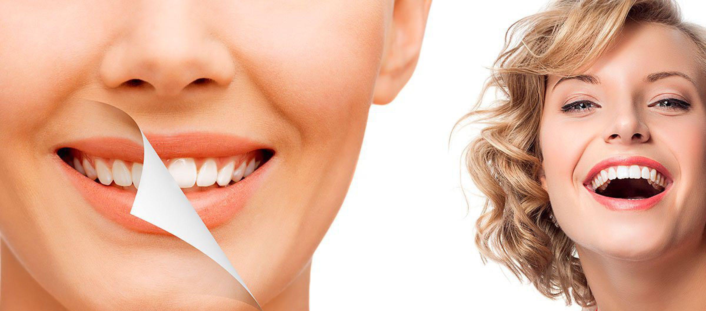 Отбеливание зубов в Омске ZOOM-4 и Beyond — Наши услуги — Стоматология Элита